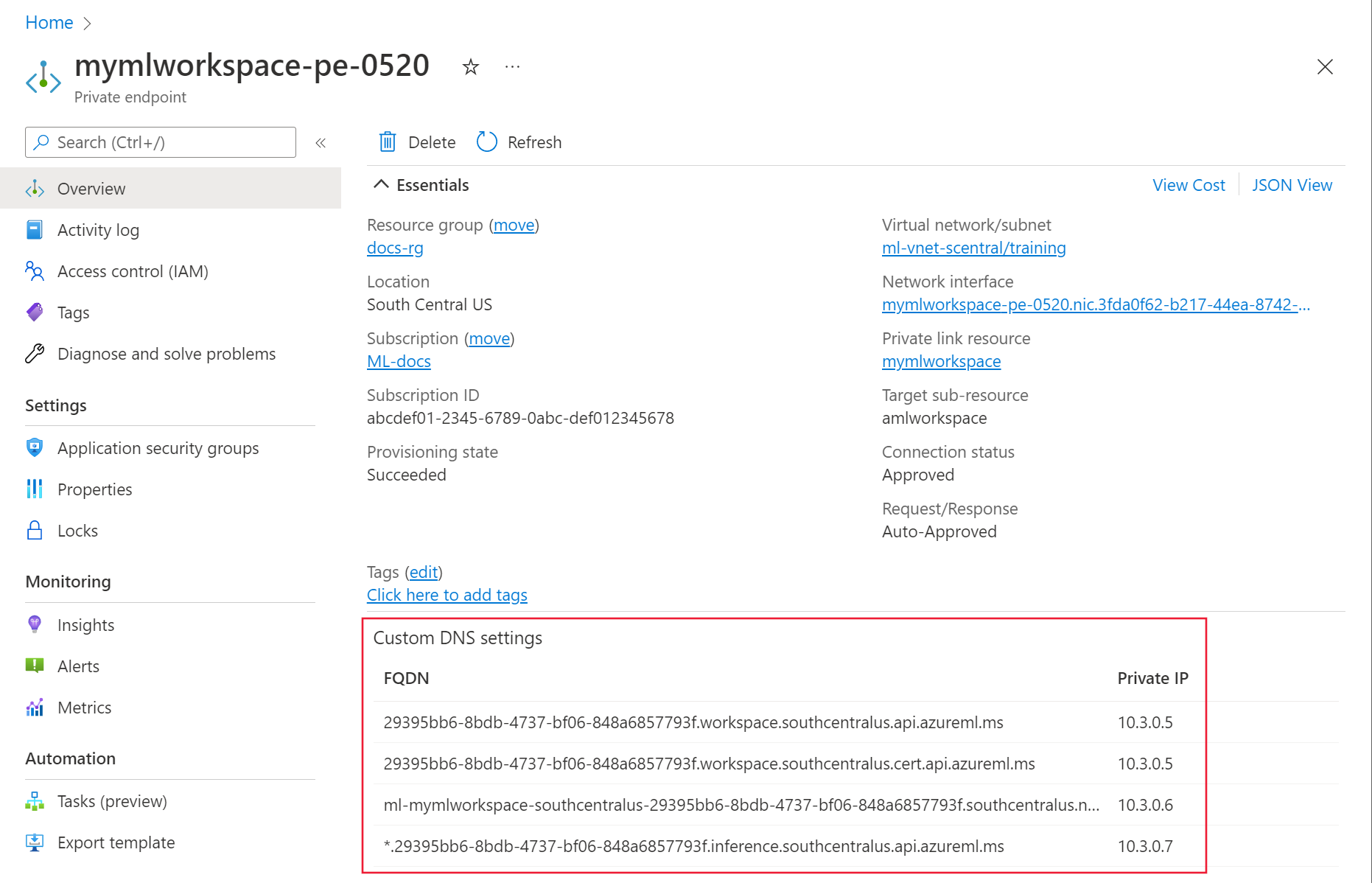 专用终结点的屏幕截图,其中突出显示了自定义 DNS 设置。